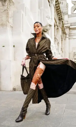 Winnie Harlow wearing Fendi bag