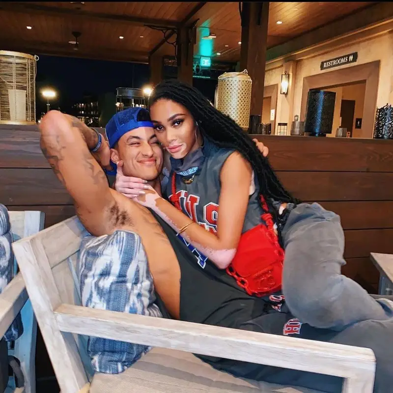 Winnie Harlow outfit in South Central Hills, 2020